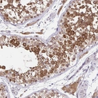 Anti-NAALAD2 Antibody