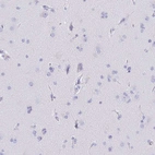 Immunohistochemical staining of human cerebral cortex shows low expression as expected.