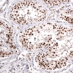 Immunohistochemical staining of human testis shows strong nuclear positivity in cells in seminiferous ducts.