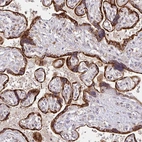 Immunohistochemical staining of human placenta shows strong membranous and cytoplasmic positivity in trophoblastic cells.