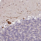 Immunohistochemical staining of human cerebellum shows strong cytoplasmic positivity in Purkinje cells.