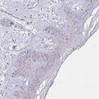 Anti-NAALAD2 Antibody