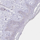 Immunohistochemical staining of human skin shows no cytoplasmic positivity in squamous epithelial cells as expected.