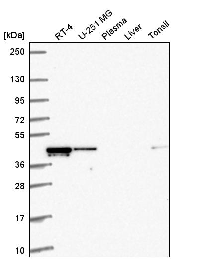 Anti-RMND5A Antibody