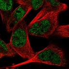 Immunofluorescent staining of human cell line RH-30 shows localization to nucleoplasm.