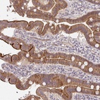 Anti-CXorf40B Antibody