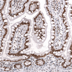 Anti-SMARCA4 Antibody