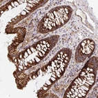 Anti-MRPL13 Antibody