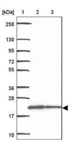 Lane 1: Marker [kDa] 250, 130, 95, 72, 55, 36, 28, 17, 10_br/_Lane 2: Human cell line RT-4_br/_Lane 3: Human cell line U-251MG sp
