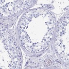 Immunohistochemical staining of human testis shows no positivity in cells in seminiferous ducts as expected.