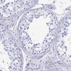 Immunohistochemical staining of human testis shows no positivity in cells in seminiferous ducts as expected.