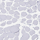 Immunohistochemical staining of human skeletal muscle shows no positivity in myocytes as expected.