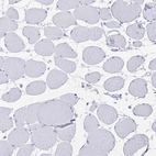 Immunohistochemical staining of human skeletal muscle shows no positivity in myocytes as expected.