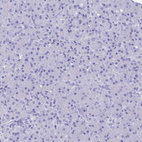 Immunohistochemical staining of human pancreas shows no positivity in exocrine glandular cells as expected.