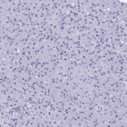 Immunohistochemical staining of human pancreas shows no positivity in exocrine glandular cells as expected.