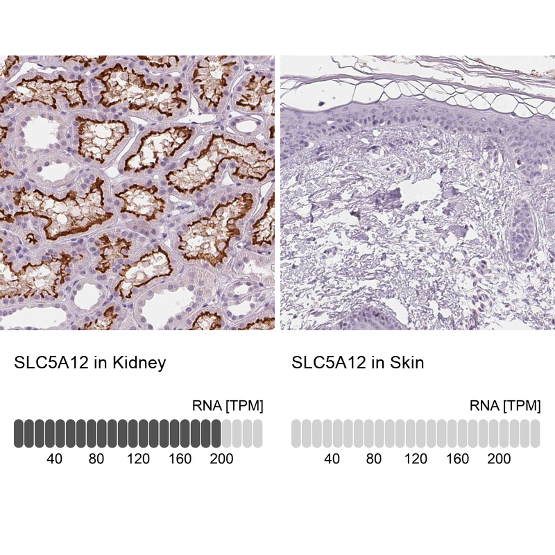Anti-SLC5A12 Antibody