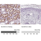 Anti-SLC5A12 Antibody