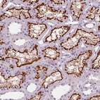Immunohistochemical staining of human kidney shows strong membranous positivity in cells in proximal tubules.