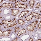 Immunohistochemical staining of human kidney shows strong membranous positivity in cells in proximal tubules.