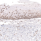 Immunohistochemical staining of human uterine cervix shows strong nuclear positivity in squamous epithelial cells.