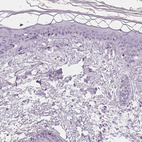 Immunohistochemical staining of human skin shows no positivity in keratinocytes as expected.