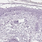 Immunohistochemical staining of human skin shows no positivity in keratinocytes as expected.