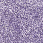 Anti-SLC5A12 Antibody
