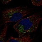 Anti-TRAPPC3L Antibody