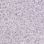Anti-PSME4 Antibody