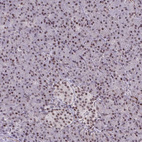 Anti-PSME4 Antibody