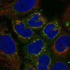 Immunofluorescent staining of human cell line CACO-2 shows localization to endoplasmic reticulum & vesicles.