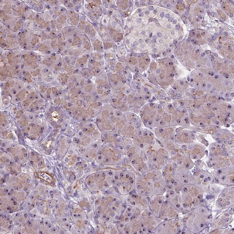Anti-RRS1 Antibody
