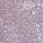 Anti-RRS1 Antibody