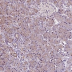 Anti-RRS1 Antibody