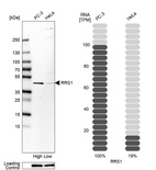 Western blot analysis in human cell lines PC-3 and HeLa using Anti-RRS1 antibody. Corresponding RRS1 RNA-seq data are presented for the same cell lines. Loading control: Anti-HSP90B1.