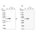 Western blot analysis using Anti-RRS1 antibody HPA060937 (A) shows similar pattern to independent antibody HPA055549 (B).
