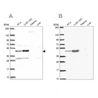 Western blot analysis using Anti-RRS1 antibody HPA060937 (A) shows similar pattern to independent antibody HPA055549 (B).