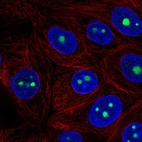 Immunofluorescent staining of human cell line MCF7 shows localization to nucleoli.
