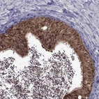 Anti-LCN9 Antibody