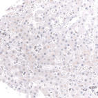 Immunohistochemical staining of human liver shows no positivity in hepatocytes as expected.
