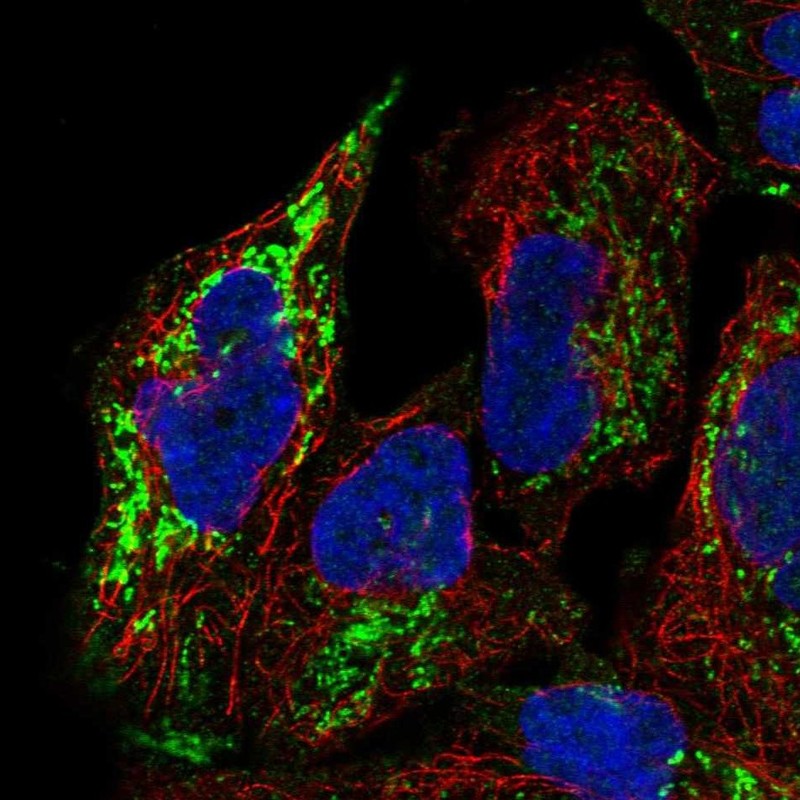 Anti-PGM2L1 Antibody