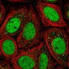 Immunofluorescent staining of human cell line SiHa shows localization to nucleoplasm & vesicles.