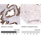 Anti-ADAM10 Antibody