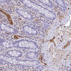 Anti-SMIM9 Antibody