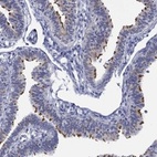 Anti-DNAL1 Antibody