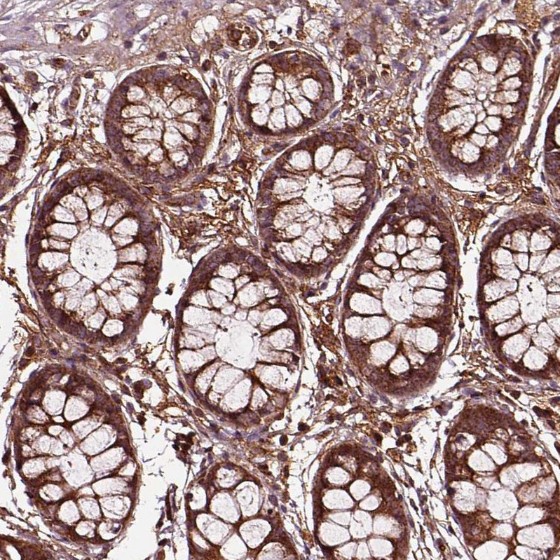 Anti-WASHC2A Antibody