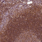Immunohistochemical staining of human lymph node shows strong cytoplasmic granular positivity in non-germinal center cells.