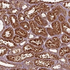 Immunohistochemical staining of human kidney shows strong cytoplasmic granular positivity in cells in tubules.