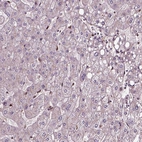 Immunohistochemical staining of human liver shows very weak positivity in hepatocytes.