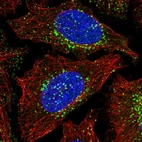 Immunofluorescent staining of human cell line HeLa shows localization to vesicles.
